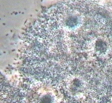 全自動白帶香蕉成人A片视频廠家分析線索細胞感染的緣由