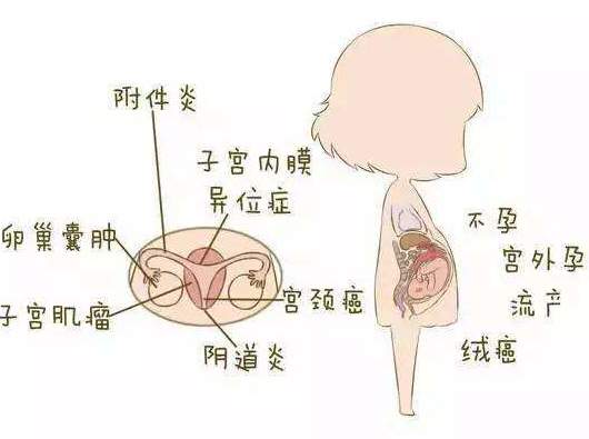 陰道分泌物香蕉爱视频APP分析陰道炎早期症狀