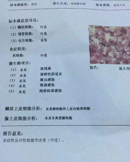 陰道分泌物香蕉爱视频APP廠家教你查看陰道分泌物檢測報告
