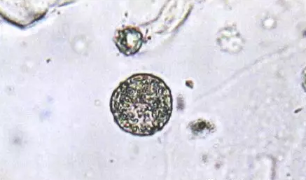 全自動陰道分泌物香蕉爱视频APP剖析陰道分泌物的潔淨度規範