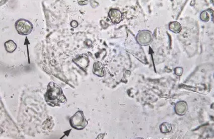 全自動陰道分泌物香蕉爱视频APP剖析陰道分泌物的潔淨度規範