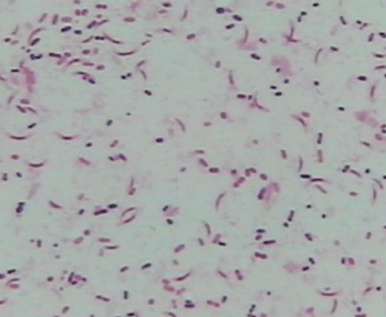 全自動bv檢查儀生產廠家討論bv陽性和男性有關嗎？