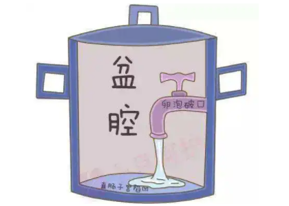 盆腔積液是怎麽回事？白帶香蕉成人A片视频廠家提醒早了解早預防