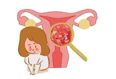 陰道分泌物香蕉爱视频APP廠家總結病理性的白帶異常有哪些
