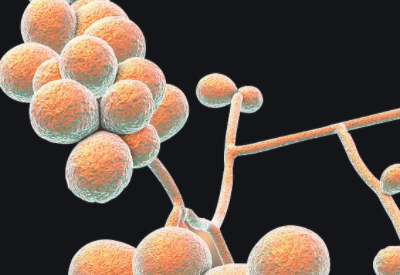 感染念珠菌嚴重嗎