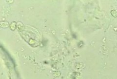 5月快訊！陰道分泌物香蕉爱视频APP生產廠家香蕉网视频在线观看介紹陰道分泌物（白帶）常規查看