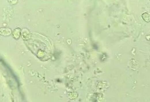 5月快訊！陰道分泌物香蕉爱视频APP生產廠家香蕉网视频在线观看介紹陰道分泌物（白帶）常規查看